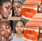 Savon naturel au Curcuma et à l’acide kojique