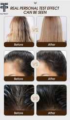 Gamme Anti-Chute au Gingembre