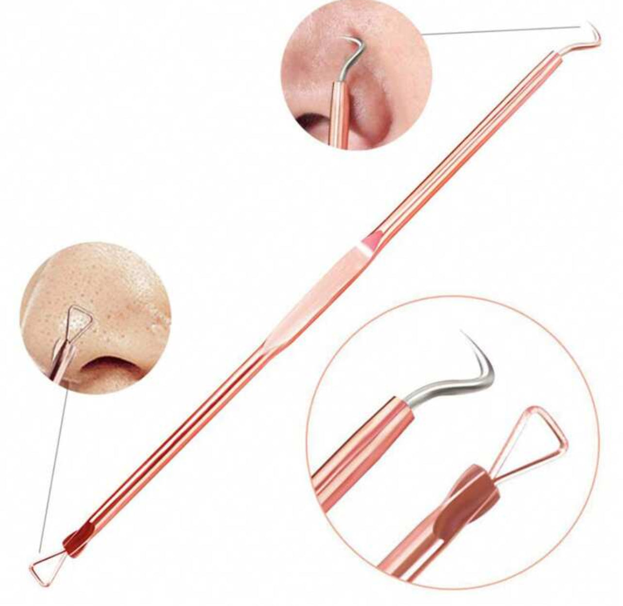 Ensemble de 4 Pièces - Kit d’Outils d’Extraction de Points Noirs et Comédons