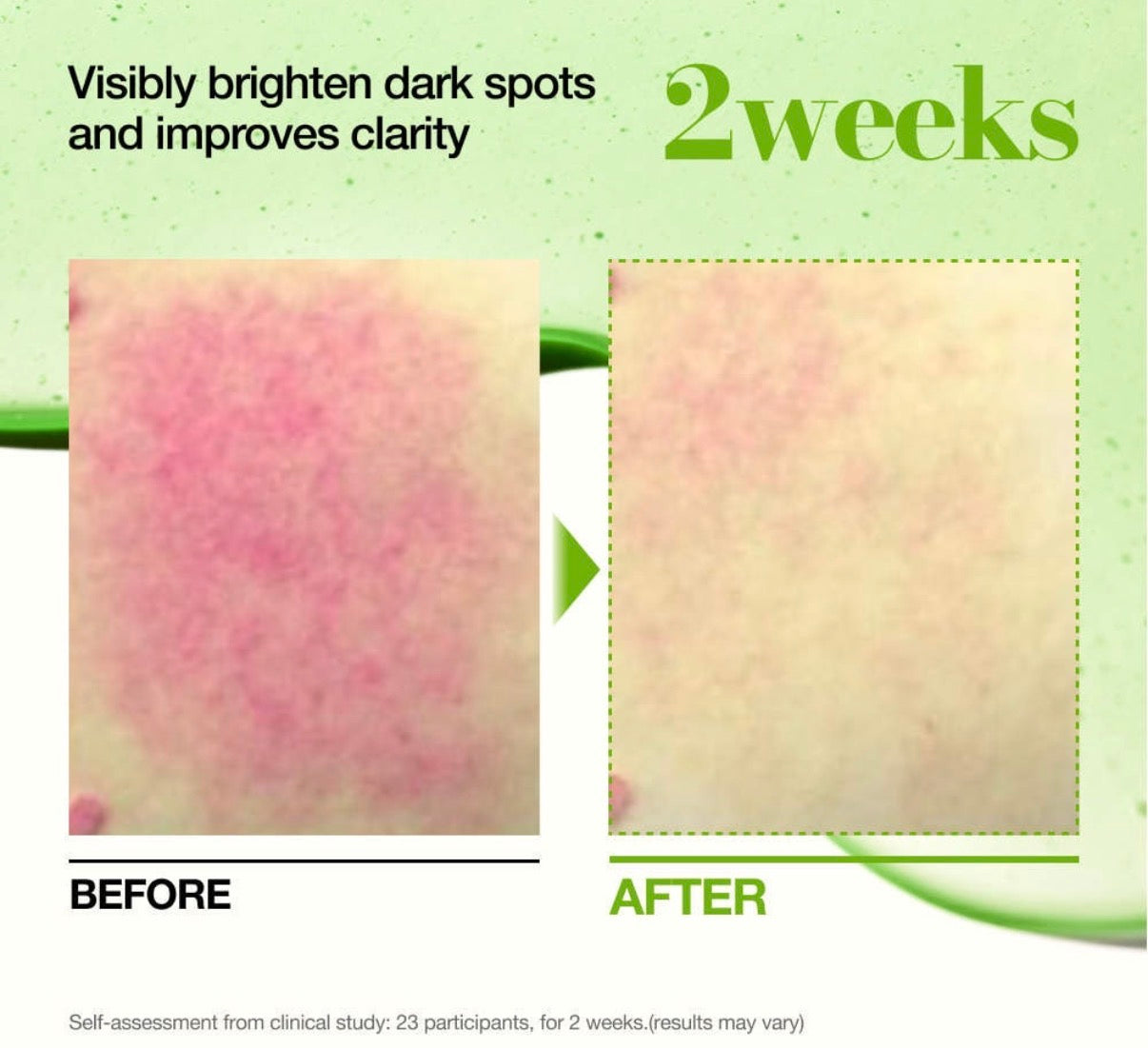 Anua SÉRUM APAISANT À L’ACIDE AZÉLAÏQUE 10 ET À L’ACIDE HYALURONIQUE ANTIROUGEUR