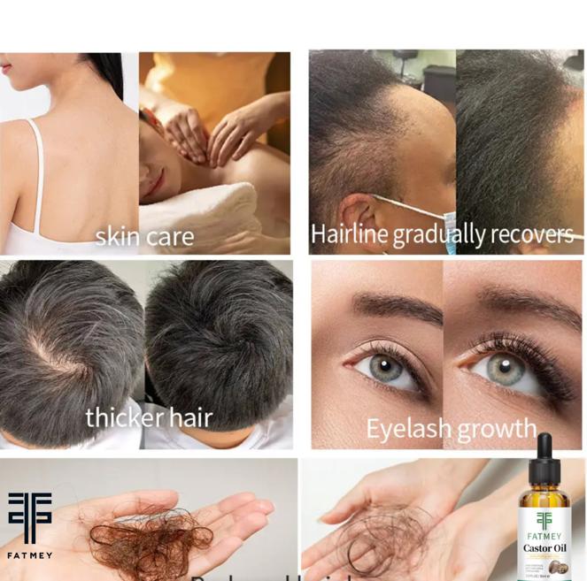 Jamaican Black Castor Oil – 30 ml | FATMEY