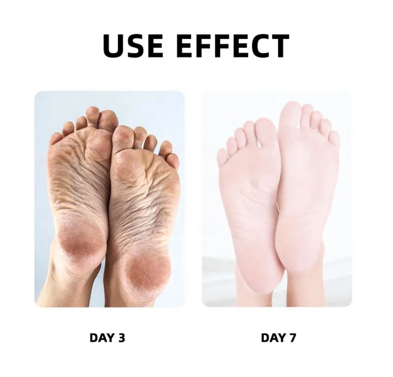 Spa de luxe pour les pieds Crystal Jelly - Thérapie aux sels naturels de la mer