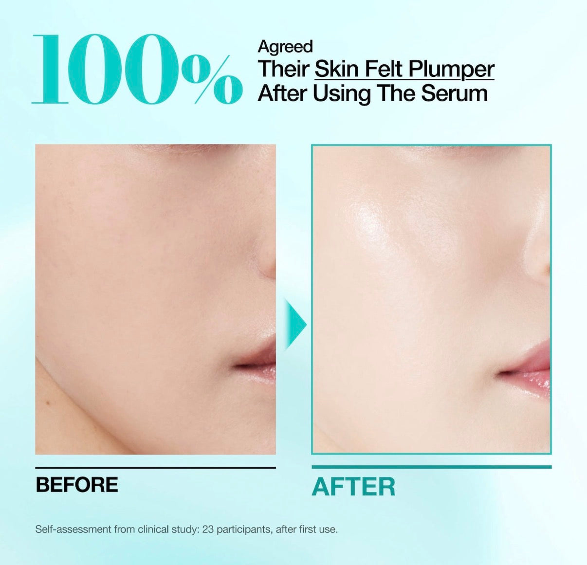 Anua 
SÉRUM PDRN À L’ACIDE HYALURONIQUE 100 CAPSULES