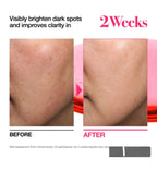 SÉRUM NIACINAMIDE 10 + TXA 4