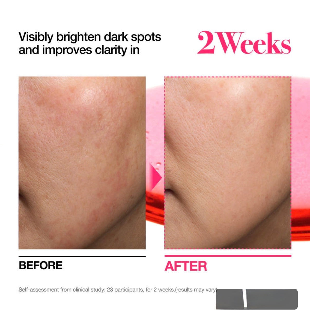 SÉRUM NIACINAMIDE 10 + TXA 4