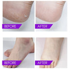 Spa de luxe pour les pieds Crystal Jelly - Thérapie aux sels naturels de la mer