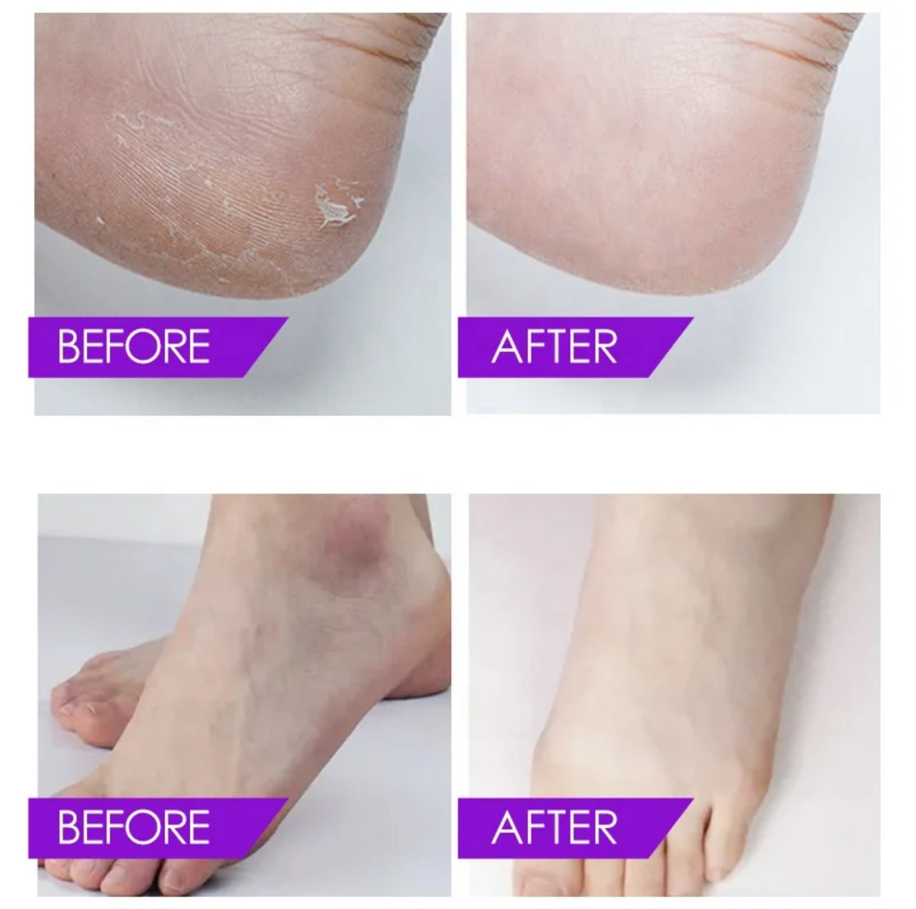 Spa de luxe pour les pieds Crystal Jelly - Thérapie aux sels naturels de la mer