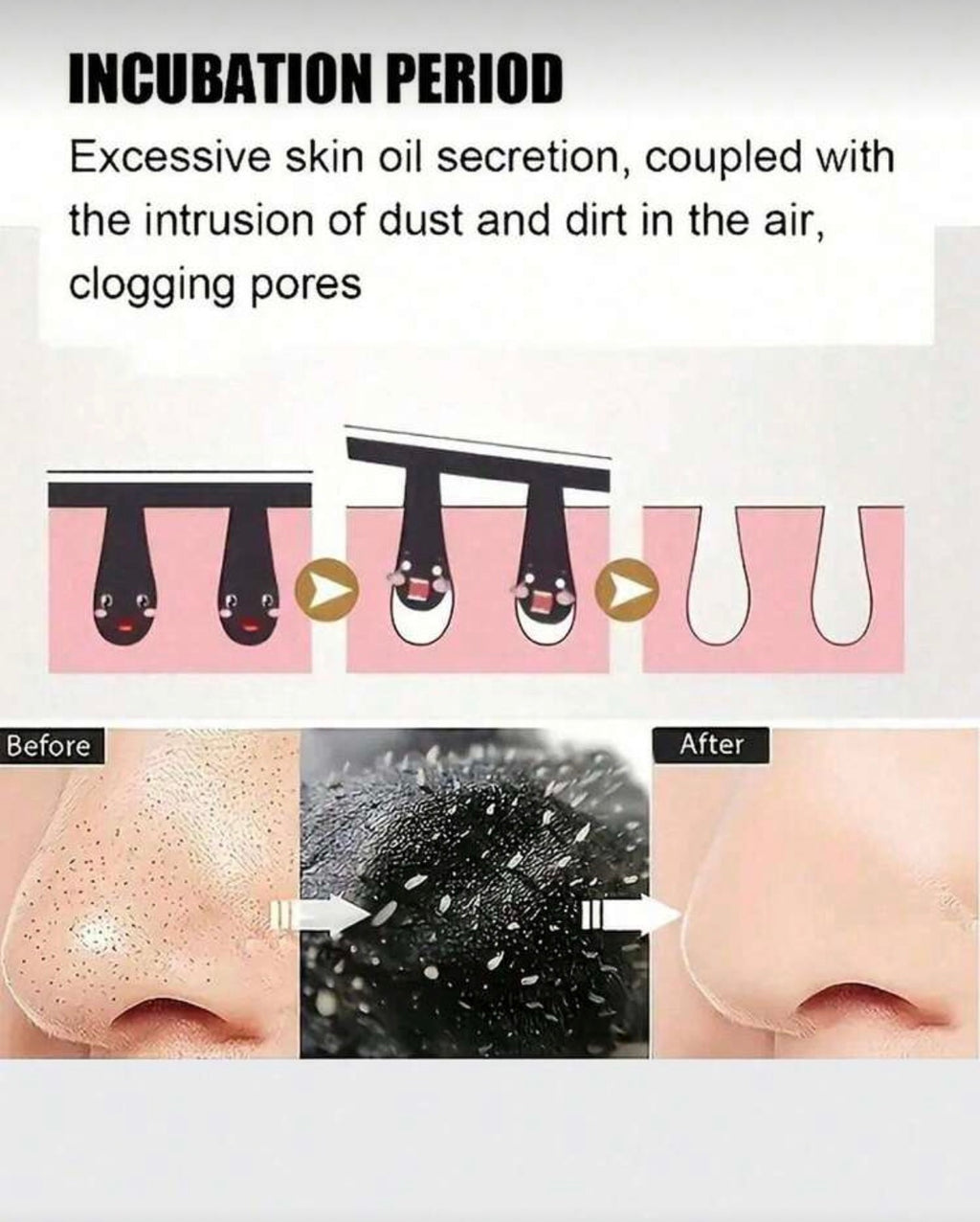 30 Charcoal Nose Strips for Blackheads