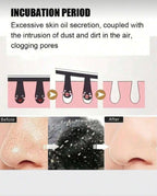 30 Patchs Nez Anti-Points Noirs au Charbon – Nettoyage Purifiant et Pores Invisibles