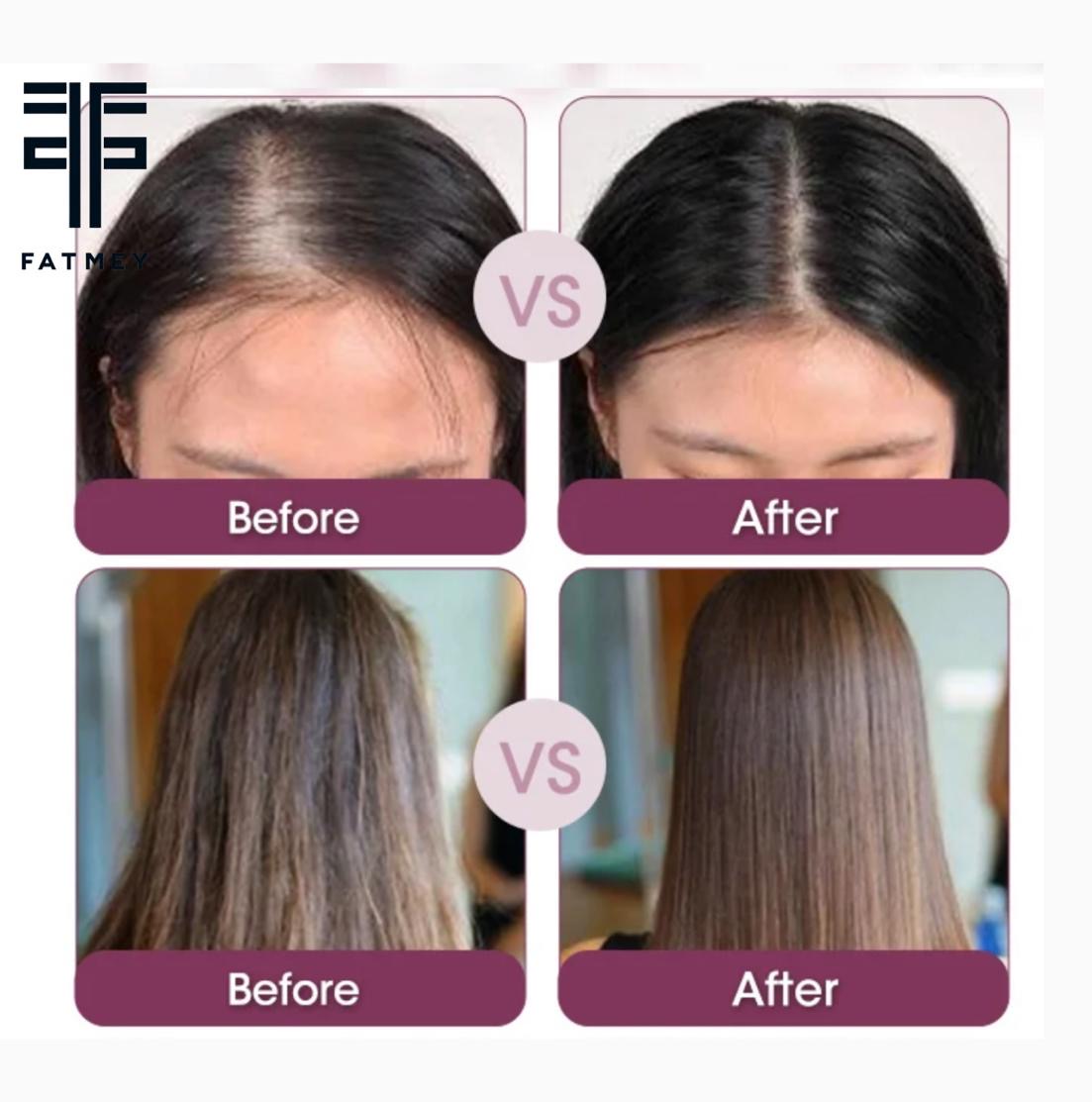 Gamme Fortifiante à l’Oignon Rouge et Graine Noire Fatmey – Soin Complet Anti-Chute et Épaississant