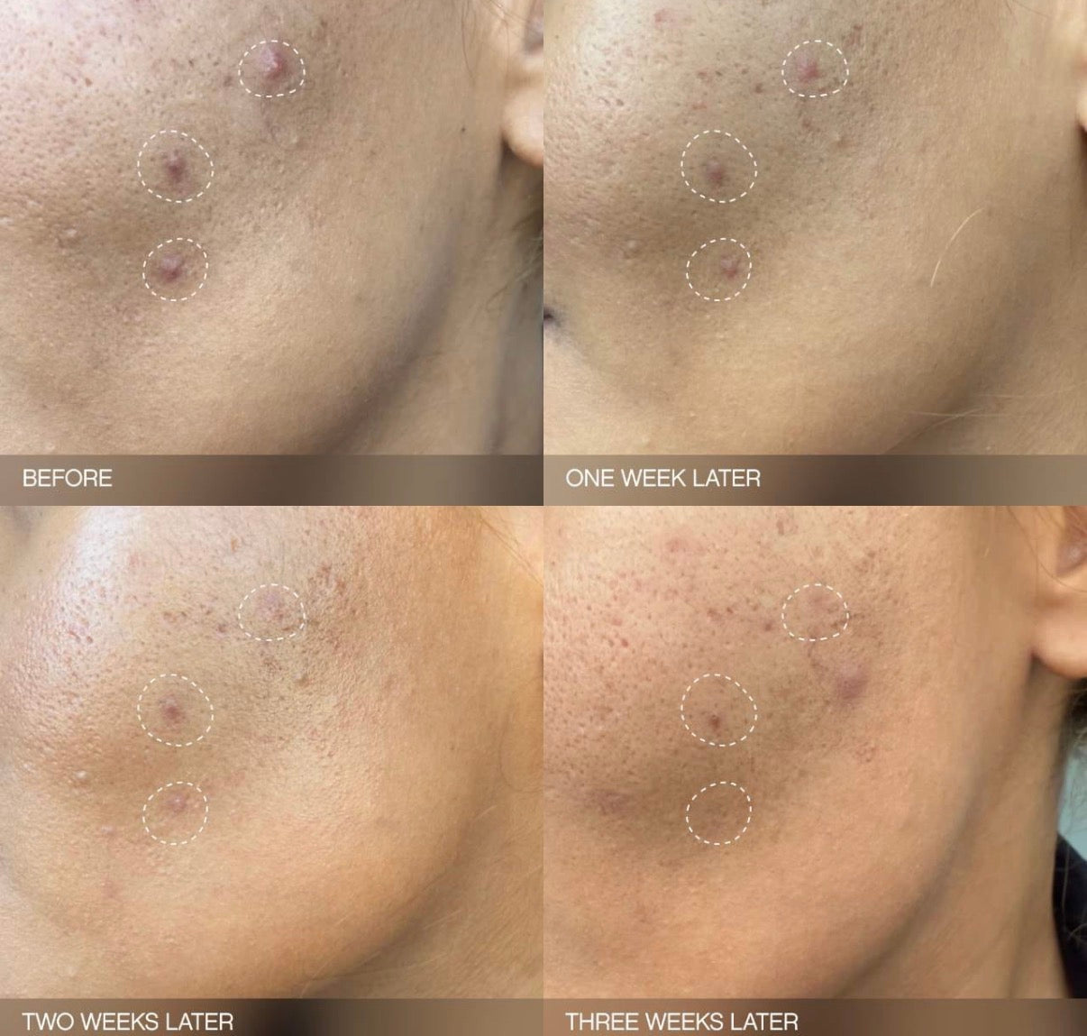 Ensemble Éclaircissant Faded par Topicals – Trio Anti-Taches Visage & Corps