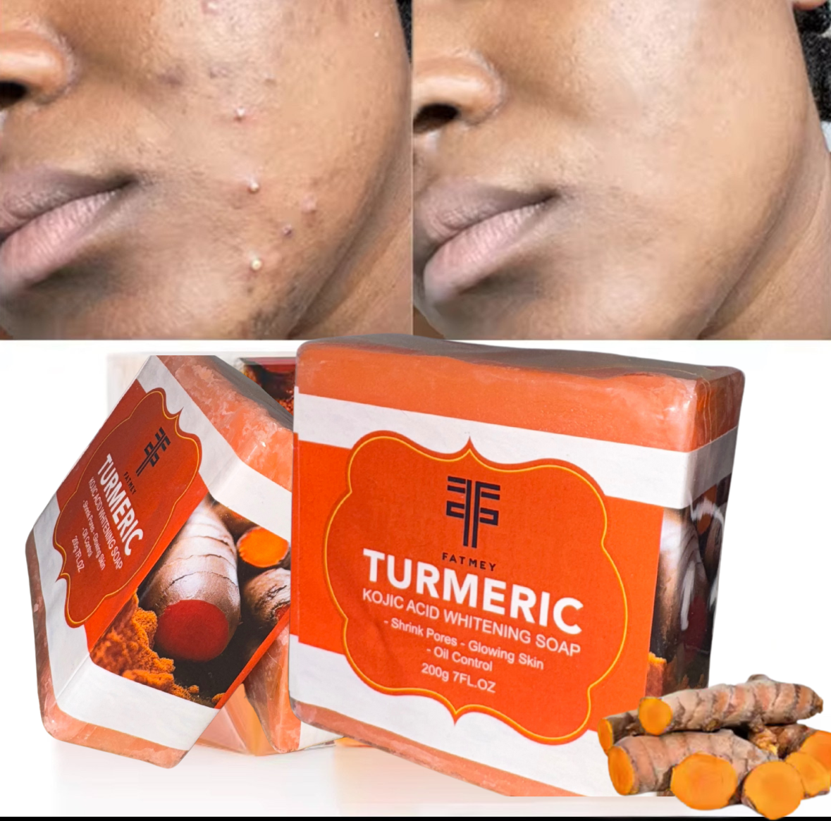 Savon naturel au Curcuma et à l’acide kojique