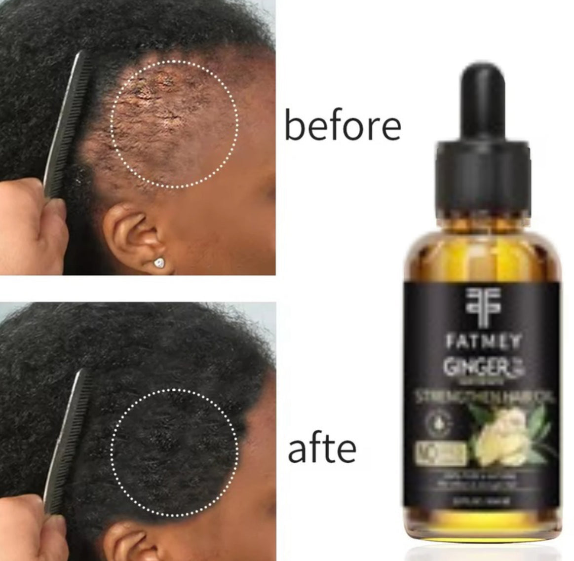 Huile de Gingembre pour la Croissance et la Fortification des Cheveux