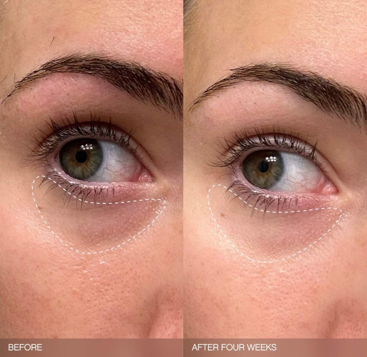 Ensemble Éclaircissant Faded par Topicals – Trio Anti-Taches Visage & Corps