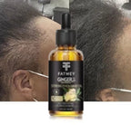 Huile de Gingembre pour la Croissance et la Fortification des Cheveux