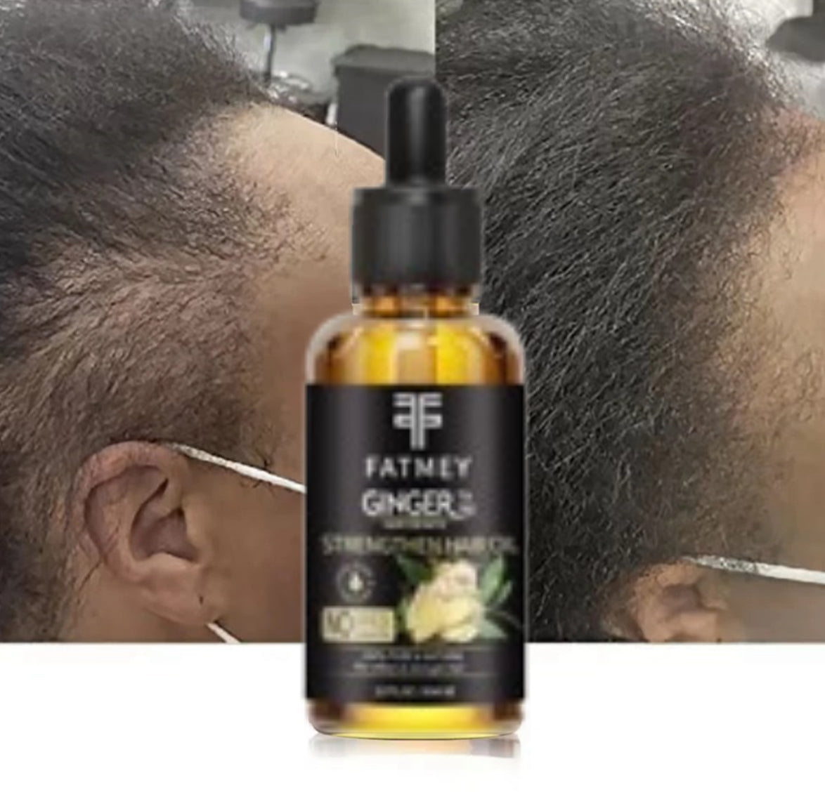 Huile de Gingembre pour la Croissance et la Fortification des Cheveux