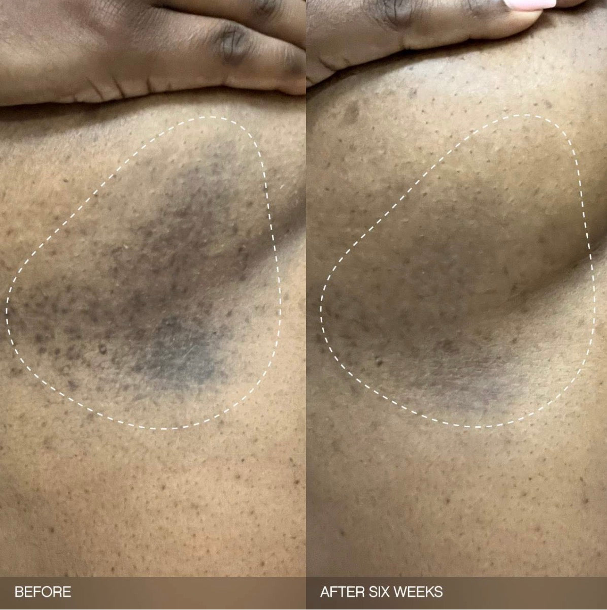 Ensemble Éclaircissant Faded par Topicals – Trio Anti-Taches Visage & Corps